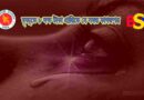 মৃত্যুজণিত অনুদান